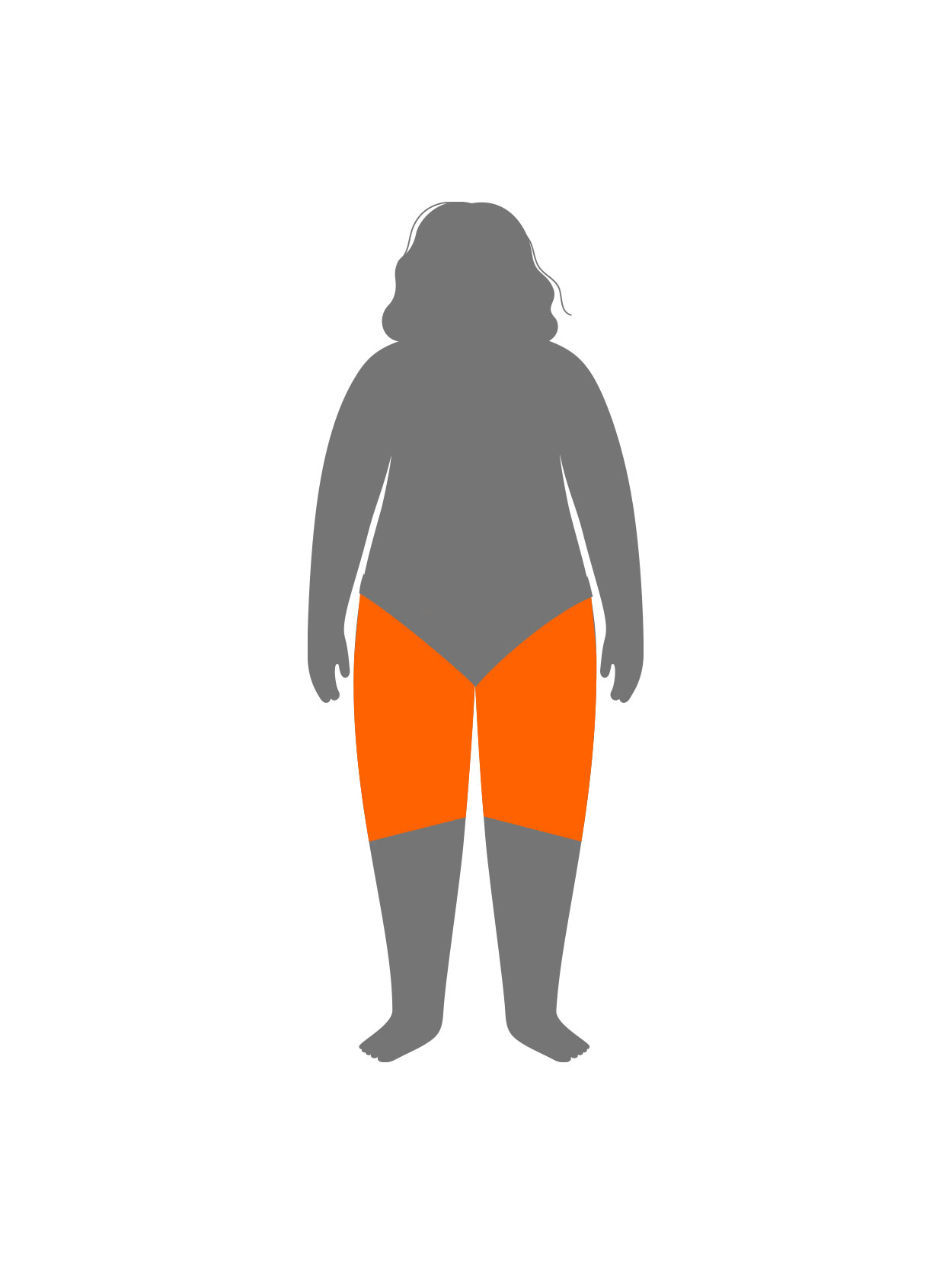 Lipedema