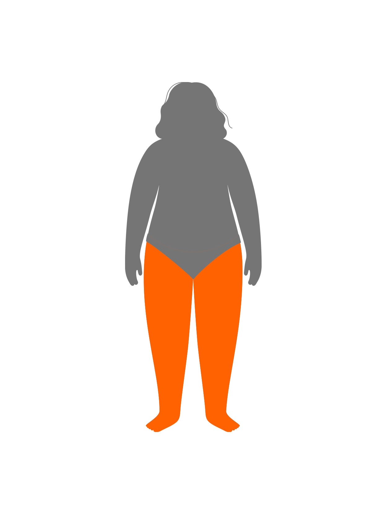 Lipedema