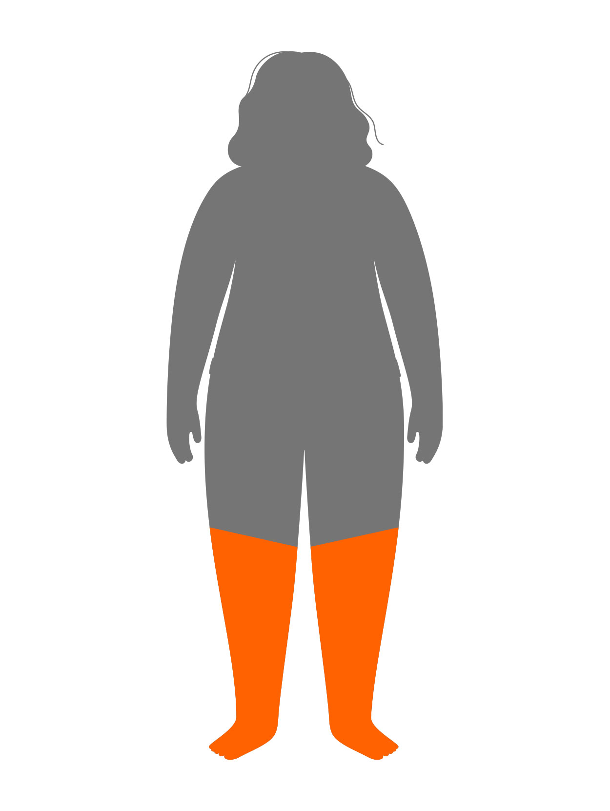 Lipedema